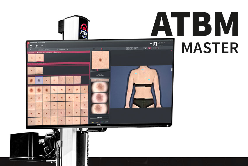 FotoFinder ATBM master