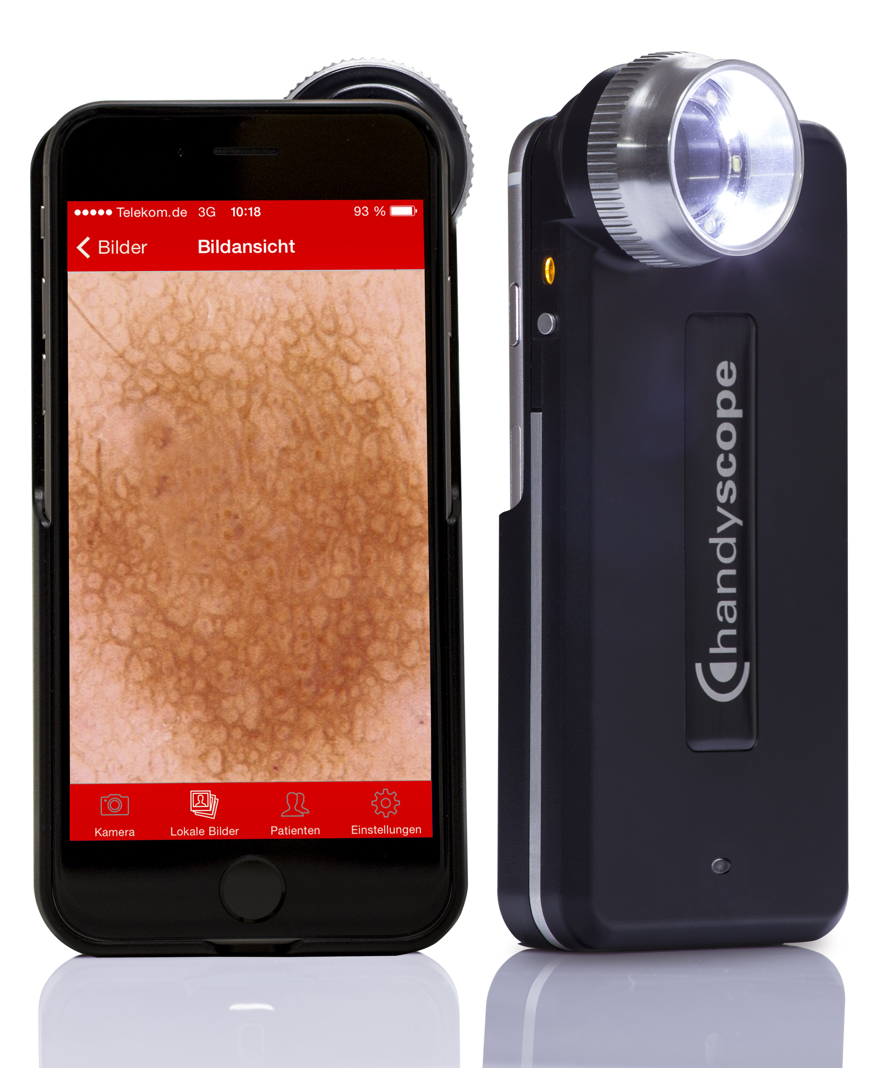 Handyscope Fotofinder Australia